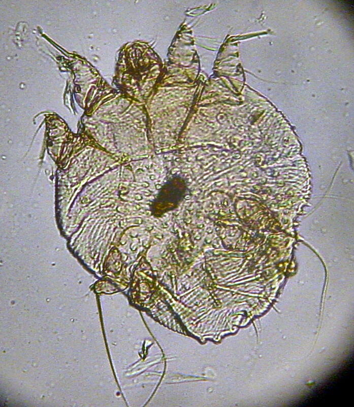 Mikroskopbilde av skabb (sarcoptes scabei)