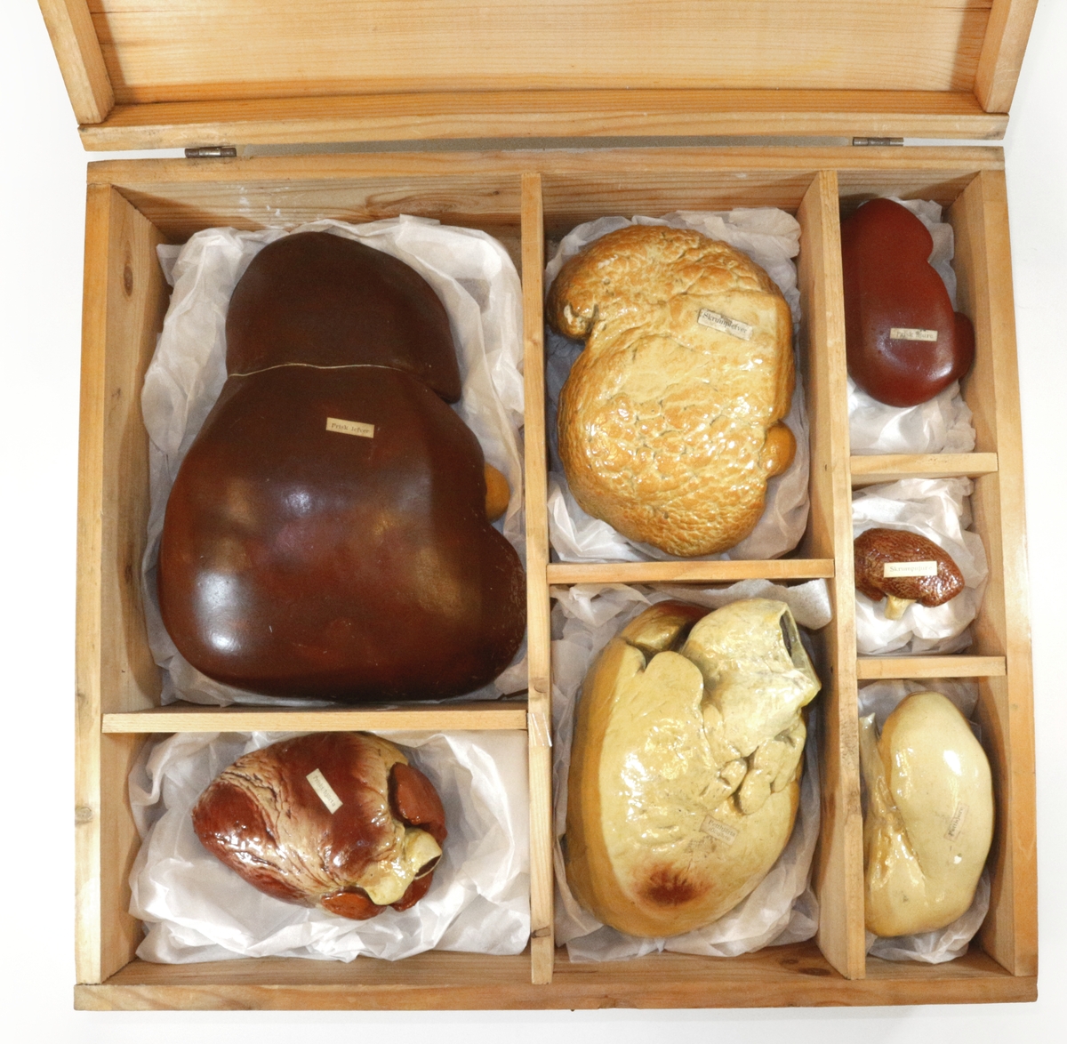 Lådan innehåller organmodeller: Friskt hjärta, fetthjärta (ölhjärta), frisk njure, fettnjure, skrumpnjure, frisk lever, skrumplever.