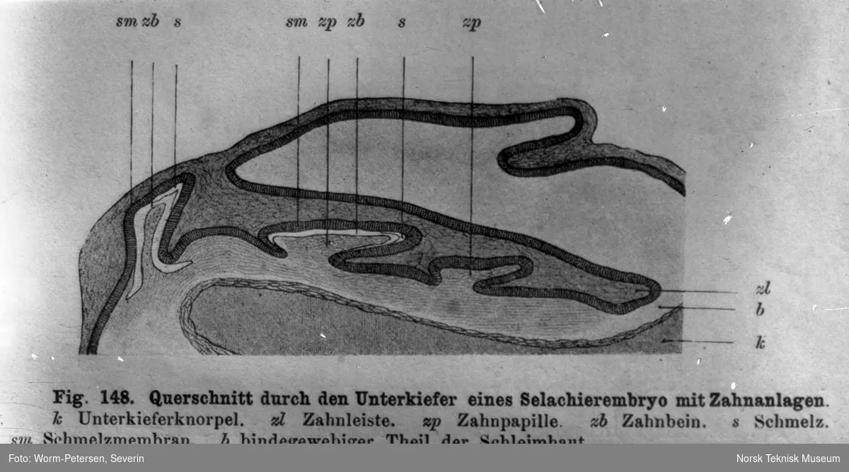 Tverrsnitt av underkjeven med tannanlegg hos et selachierembryos