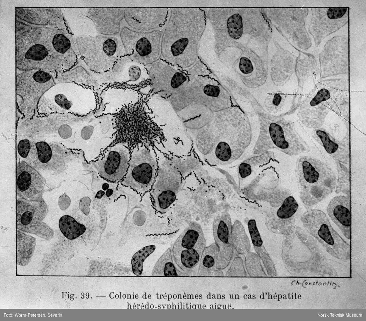 Syfilis, bakteriologi