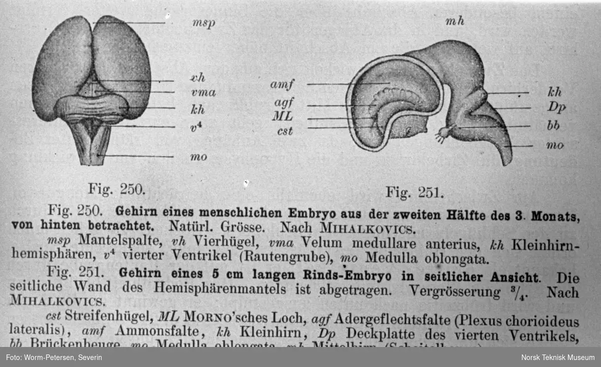 Skisse av hjernen til et menneskelig embryo