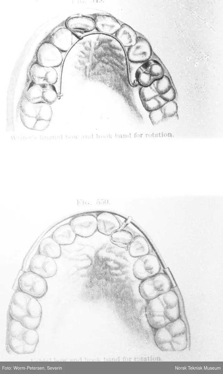 Illustrasjon av tannarbeid