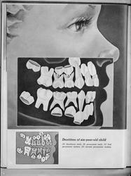 Plansje over tennene til et 6 års gammelt barn